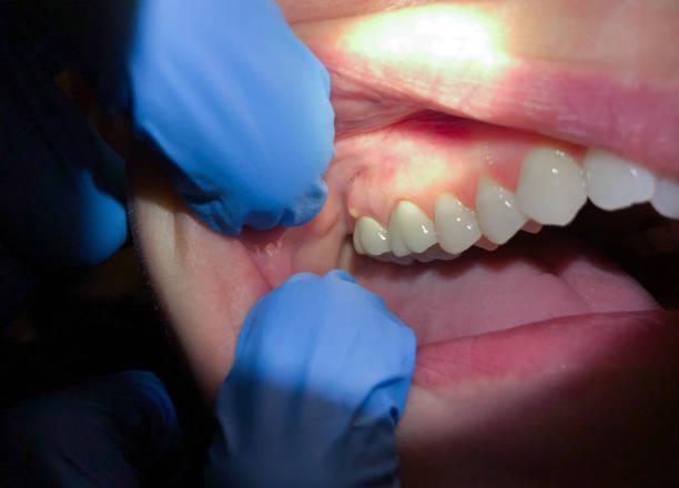 Best Emergency Treatment for Toothache in Staunton, IL