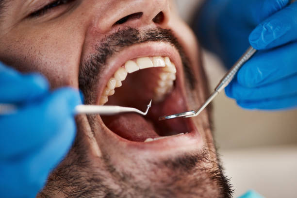 Best Emergency Broken Tooth Repair in Staunton, IL