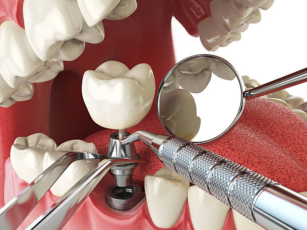 Best Emergency Treatment for Toothache in Staunton, IL