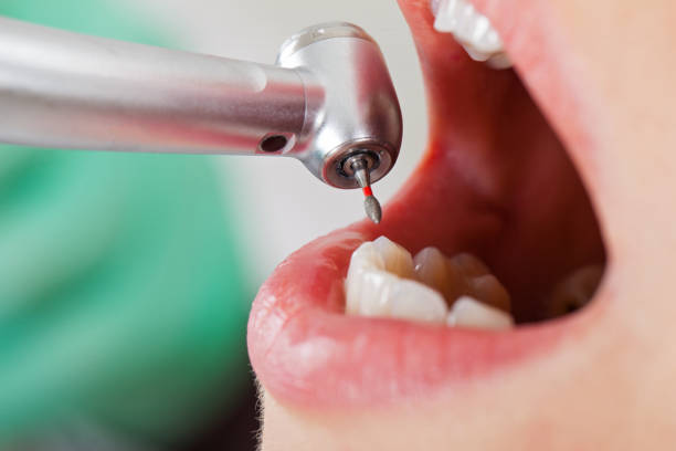 Best Emergency Treatment for Toothache in Staunton, IL